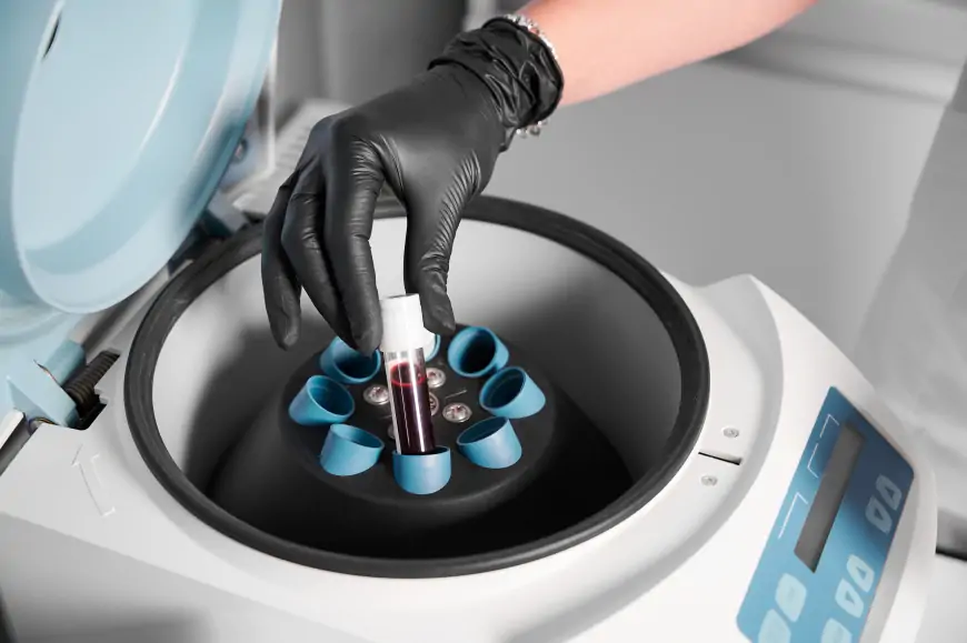 Nova medicinska centrifuga na zadarskoj transfuziji