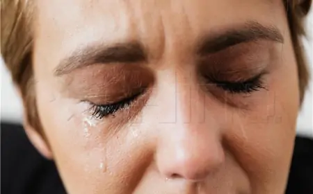 Strah od crvenjenja lica samo pogoršava problem