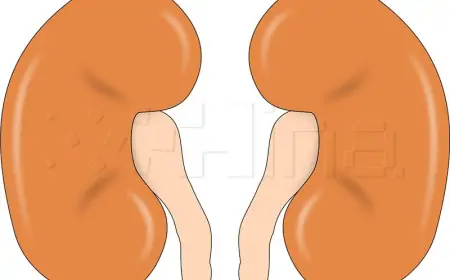 U Hrvatskoj oko 300.000 oboljelih od kronične bubrežne bolesti