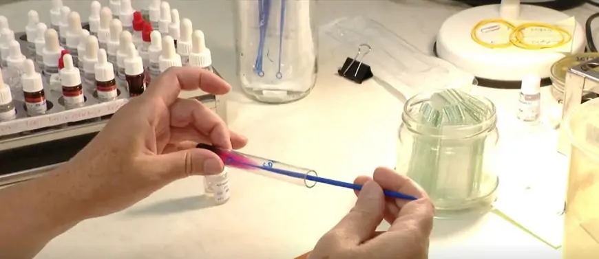 JOŠ SE NE ZNA IZVOR MASOVNE ZARAZE SALMONELOM NA LOŠINJU: "KAD SAM UGLEDALA GOSPOĐU..."