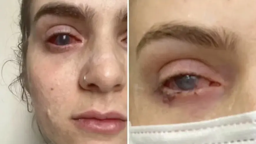 POPILA TABLETU PROTIV BOLOVA KOJU UZIMAJU BROJNI HRVATI, A ONDA JOJ SE ŽIVOT ZAUVIJEK PROMIJENIO: " BILO JE KAO DA SAM IZNUTRA IZGORJELA"