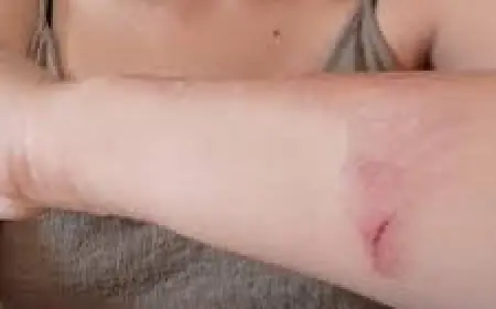 PIJANI MUŠKARAC NAPAO NOVINARKU DOK JE BILA NA ZADATKU. SUTKINJA: JEDNAKO SU KRIVI