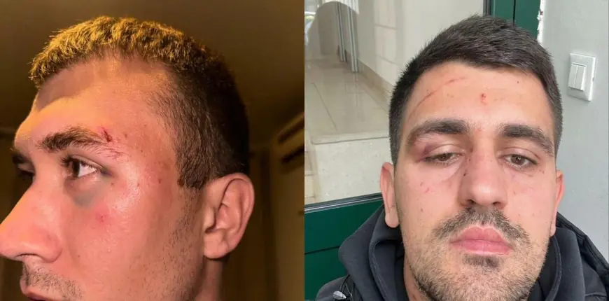 UŽAS U DALMACIJI: NOGOMETAŠI PRETUČENI NAKON UTAKMICE, TUKAO IH I PREDSJEDNIK PROTIVNIČKOG KLUBA?