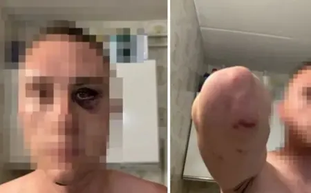 UHVAĆEN JEDAN OD NAPADAČA, ZA TROJICOM SE JOŠ TRAGA: BRUTALNO PRETUKLI MLADIĆE IZ SLOVENIJE