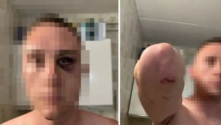 UHVAĆEN JEDAN OD NAPADAČA, ZA TROJICOM SE JOŠ TRAGA: BRUTALNO PRETUKLI MLADIĆE IZ SLOVENIJE