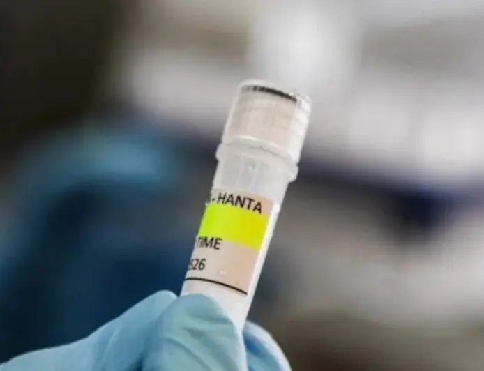 VRATIO SE VIRUS KOJI JE IZAZVAO MEĐUNARODNU UZBUNU: OTKRIVEN NOVI SLUČAJ U EUROPI