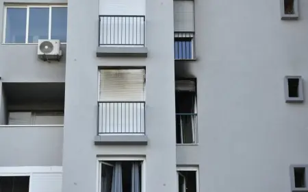 DIJETE IZ POŽARA IMA OPEKLINE NA 54 POSTO TIJELA. NA RESPIRATORU JE